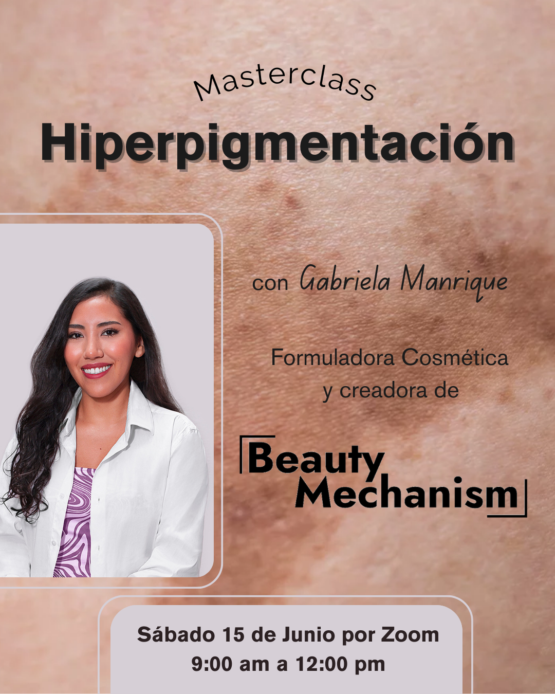 Masterclass: Hiperpigmentación de la piel